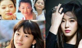 老综艺爆料明星整容视频,老综艺爆料视频曝光惊人内幕